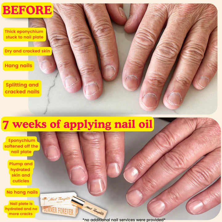 NAIL THOUGHTS Summer Forever Nail Oil